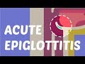 What is Acute Epiglottitis?