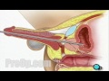 Cystoscopy Male via Penis Surgery - Patient Education