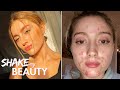 I Didn't Get Acne Until I Turned 21 | SHAKE MY BEAUTY