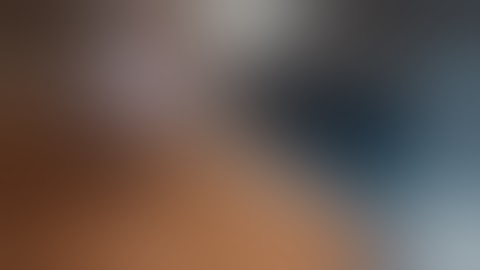 Superior Capsular Reconstruction