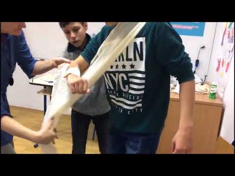 Video: Nenormálne Dlhý Prst Na Jeho Ruke Preslávil Chlapíka - Alternatívny Pohľad