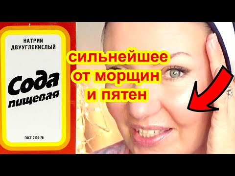 СМЕШАЙТЕ СОДУ и ФАРФОРОВАЯ КОЖА даже в 70 лет! ОТ МОРЩИН и ПЯТЕН  Рецепт