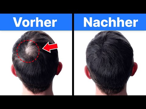 Video: Haare nachwachsen lassen: Können Naturheilmittel helfen?