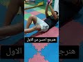 بداية تأهيل كسر عظمة الفخذ Femur Frecture
