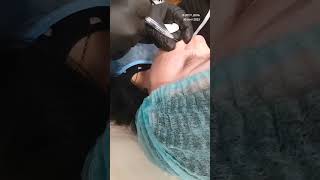 Убираем кисетные морщины над верхней губой. #кисетныеморщины