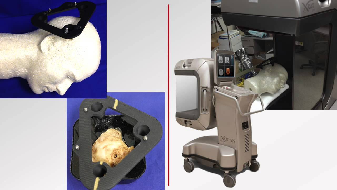 The ANSR Acoustic Neuroma Surgery Robot YouTube