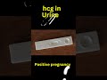 Positive Pregnancy TEST vs Negative in 30 SECONDS Time Lapse #shorts #nursing #medical #sperm