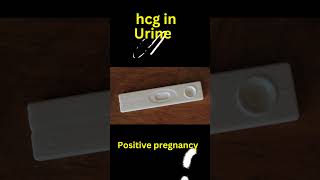 Positive Pregnancy TEST vs Negative in 30 SECONDS Time Lapse #shorts #nursing #medical #sperm