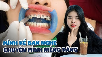 30 TRIỆU CHO NỤ CƯỜI MỚI - SẴN SÀNG CƯỜI CẢ NGÀY SAU KHI NIỀNG RĂNG