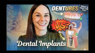 Dentures VS Dental Implants | Let's Discuss What's Best!