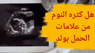 هل كثرة النوم من علامات الحمل بولد | كثرة النوم من علامات الحمل بولد، حقيقة أم خرافة؟