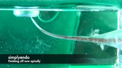 WaveOne GOLD, a step by step guide from simplyendo