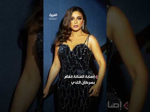 أنغام تصرح لأول مرة عن وضعها الصحي