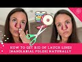 How To Get Rid Of Laugh Lines Naturally [Easy Kinesio Tape Application For Nasolabial Folds]