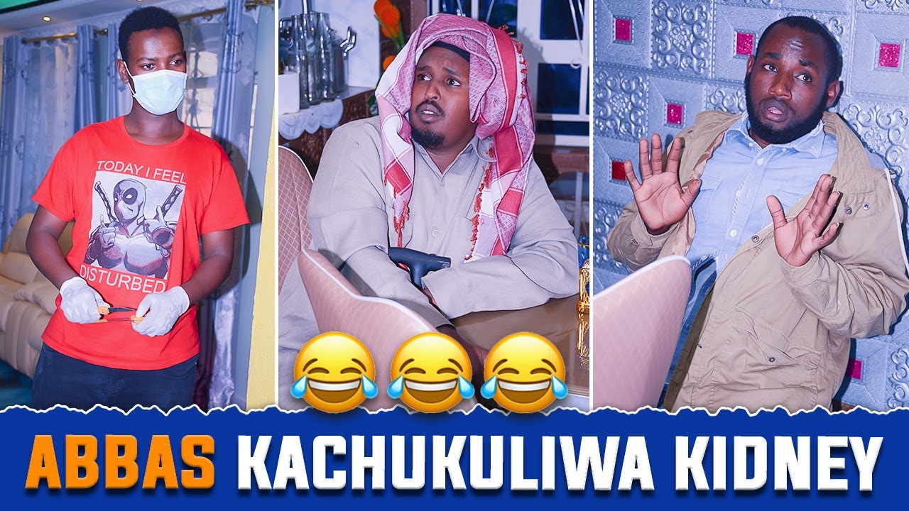 Ethio Junior | Abbas kanyanganywa kidney akitafuta kazi🤣🤣🤣