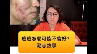 莊醫師講勵志故事-治療青春痘不是一件困難的事！