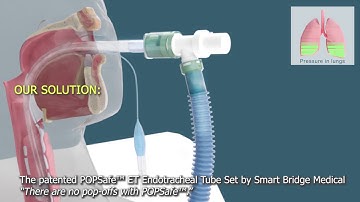 The patented POPSafe™ ET Endotracheal Tube Set by Smart Bridge Medical - 3D Medical Animation