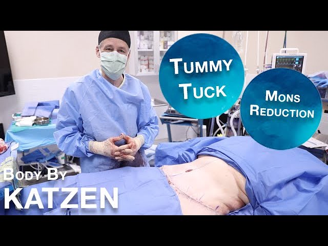 Testimonial Tuesday  Tummy Tuck focusing on Mons Reduction 