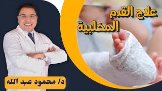 علاج انحراف القدم للداخل عند الأطفال / القدم المخلبية  - clubfoot