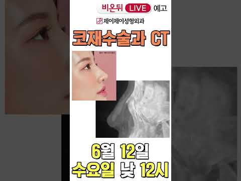 [비온뒤 예고] 코 재수술과 CT - 유튜브 의학채널 비온뒤 (제이제이성형외과)#shorts