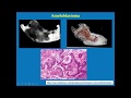 Pathology Lecture - Tumor-like Lesions and Tumors of Oral Cavity and Jaws
