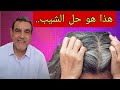 المادة الجبارة التي تقضي على الشيب و الصلع مع الدكتور محمد الفايد