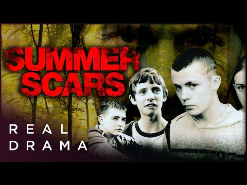 SUMMER SCARS