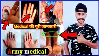 Indiana Army medical video ! army medical kaise hota hai video 2021 ! Medical की पूरी जानकारी