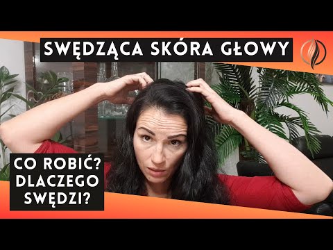 Wideo: 3 proste sposoby leczenia swędzącej skóry głowy po użyciu farby do włosów