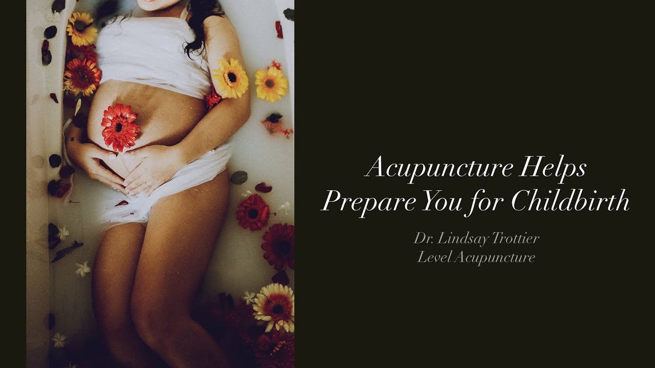 Acupuncture Helps You Prepare for Childbirth