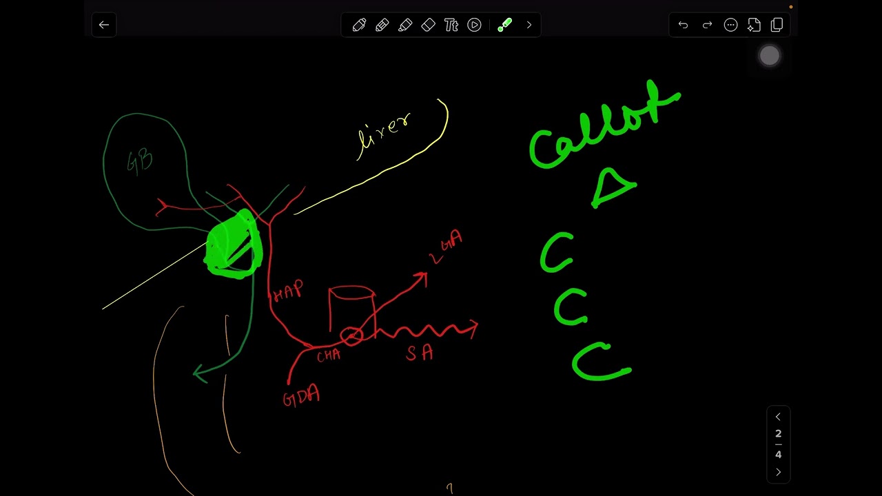 Calots triangle MCQ l Everyone clips the wrong vessel