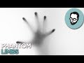 Phantom Limbs: When You Feel A Hand That Isn&#39;t There | Random Thursday