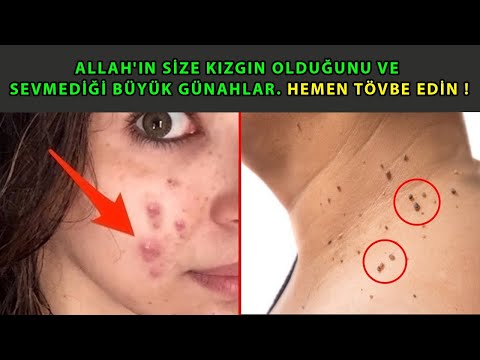 Allah'ın Size Kızgın