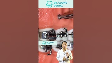 Hình ảnh mô hình đặt vít niềng răng | Dr Cường Offical #drcuong #shorts