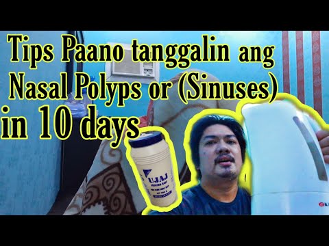 Video: Paano Pakawalan ang Presyon ng Sinus (na may Mga Larawan)