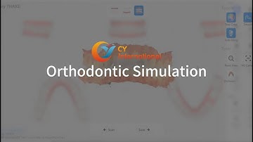 Intraoral Scanner-Orthodontic Simulation