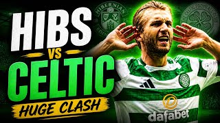 Celtic vs Hibs HUGE Preview 🍀 | Nygren Debate &amp; Board Madness?