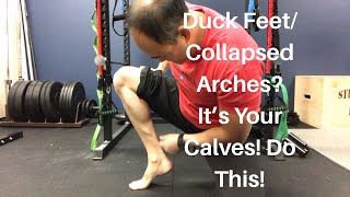Duck Feet/Collapsed Arches? Running/Squatting Problems? It’s Your Calves! Do This! | Dr Wil & Dr K