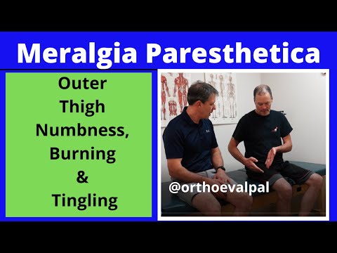 Meralgia Paresthetica (Outer thigh numbness, burning and tingling)
