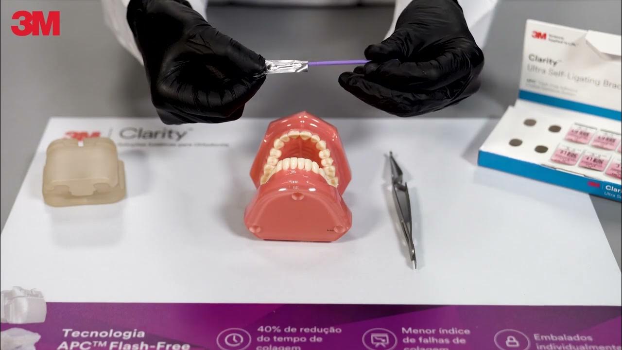 Protocolo de Colagem com Transbond™ Plus Self Etching Primer YouTube