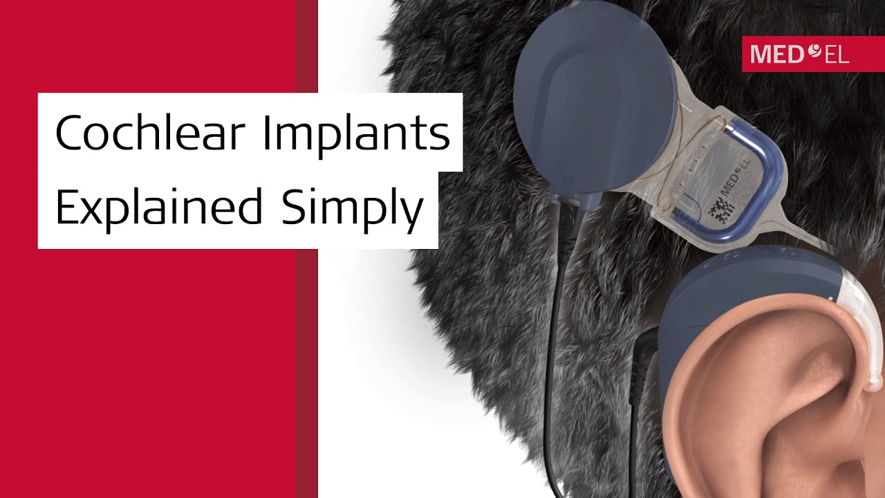 How Do Cochlear Implants Work? SYNCHRONY System & SONNET 3 | MED-EL