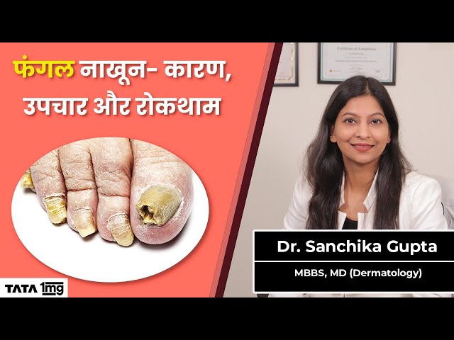 Nails indicate warning signs of cancer arthritis and heart disease do not  ignore their symptoms | नाखूनों पर कैंसर, गठिया और दिल की बीमारी के इस तरह  मिलते हैं संकेत; नजरअंदाज करना