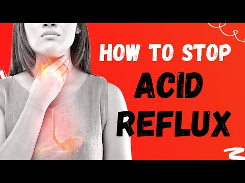 🔴 ACID REFLUX | 10 Foods You Should Add To Your Diet To Stop Heartburn.