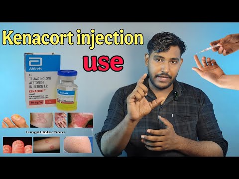 Kenacort injection / Triamcinolone steroid infection uses, side effects 
