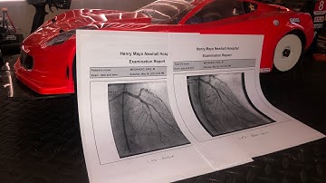 Arrma Limitless 8S speed pass almost killed me ( not click bait ) ??
