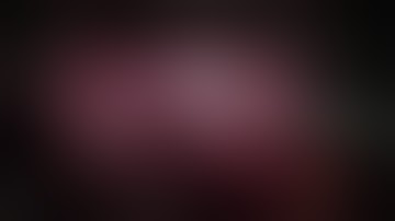 Robot-assisted radical prostatectomy--whole case at 2x speed