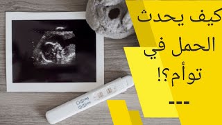 كيف يحدث الحمل بتوام | كيف يحدث الحمل في توأم | هل تعلم كيف يحدث حمل التوأم ؟ سبحان الله