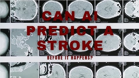 Can AI Predict a Stroke?  Stroke Prediction Model with 93% Accuracy (Altair Contest)