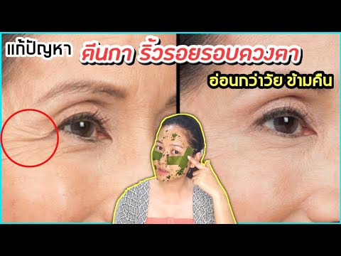 สูตรลับ แก้รอยตีนกา ริ้วรอยรอบดวงตาเหี่ยว ให้อ่อนกว่าวัย แค่ข้ามคืน l สรรหามาทำ