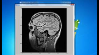 Dicom Processing with ITK 0 2
